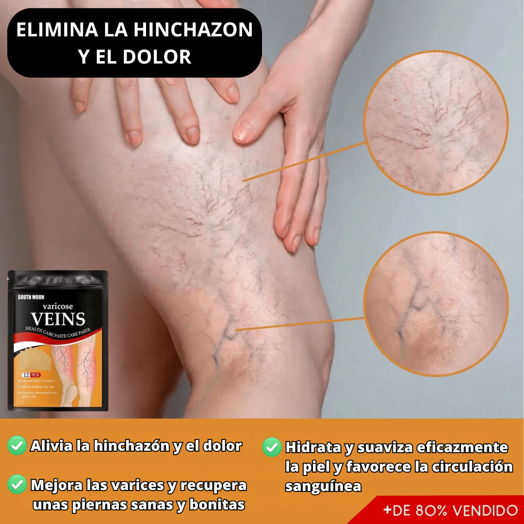 ¡Adiós Várices y Dolor! Parches Naturales que Activan la Circulación y Alivian al Instante