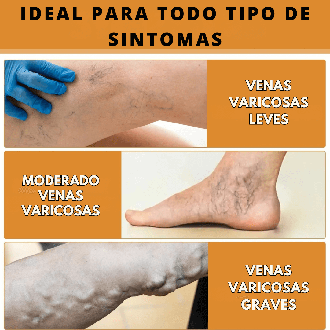 ¡Adiós Várices y Dolor! Parches Naturales que Activan la Circulación y Alivian al Instante