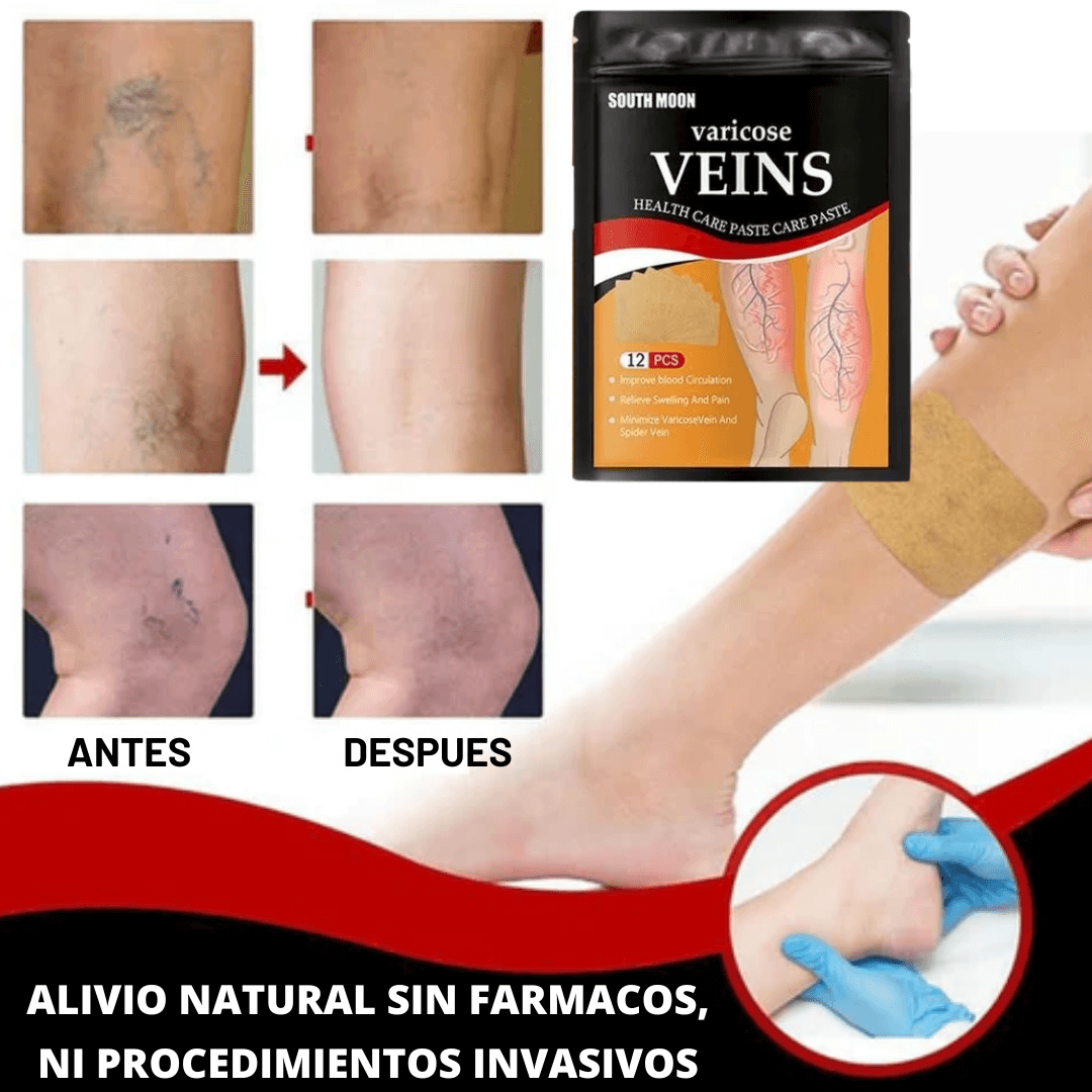 ¡Adiós Várices y Dolor! Parches Naturales que Activan la Circulación y Alivian al Instante