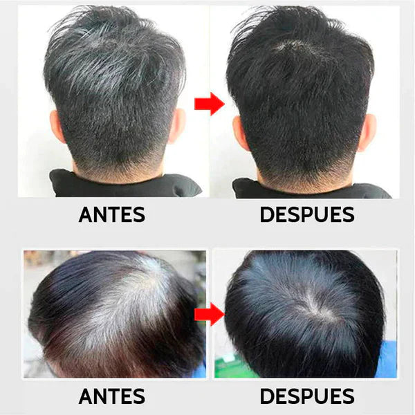 SHAMPOO - CUBRE CANAS