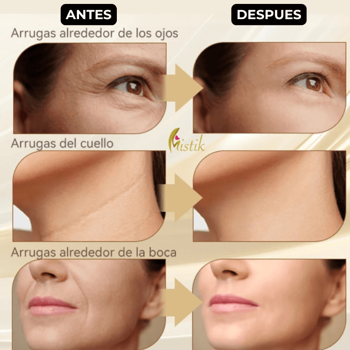 Masajeador Facial Rejuvenecedor PREMIUM