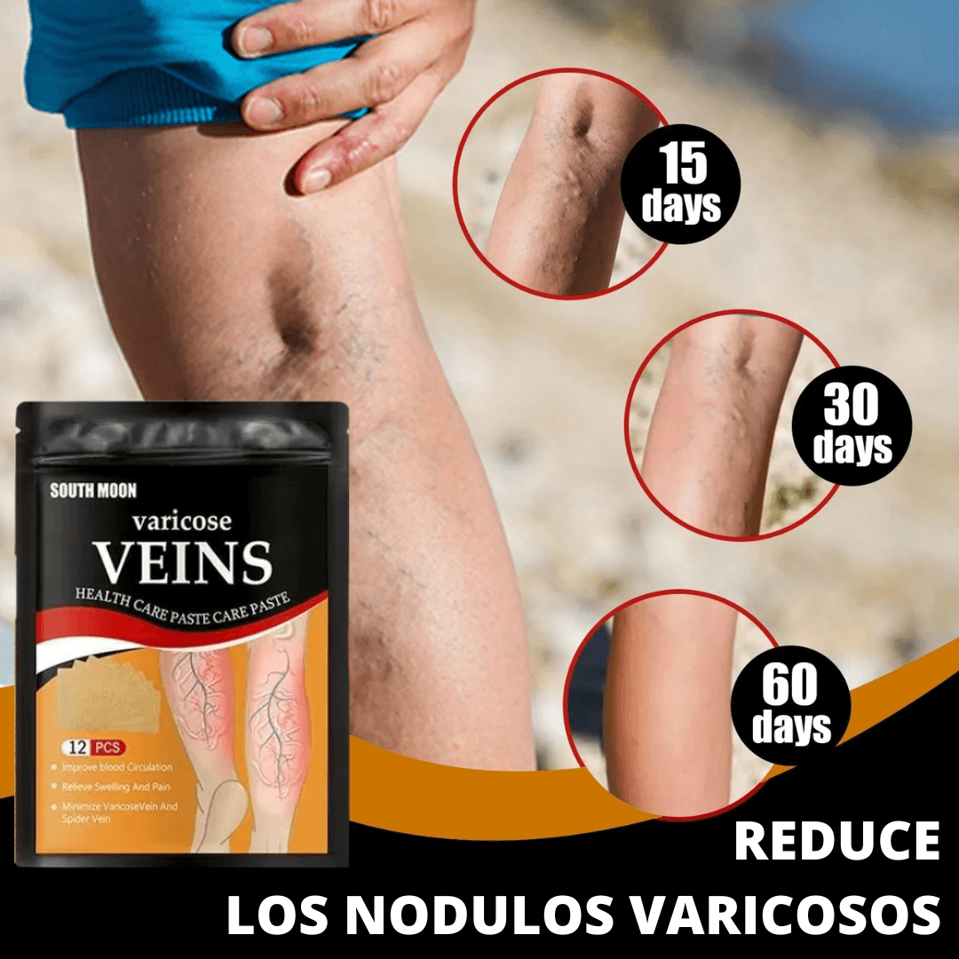 ¡Adiós Várices y Dolor! Parches Naturales que Activan la Circulación y Alivian al Instante