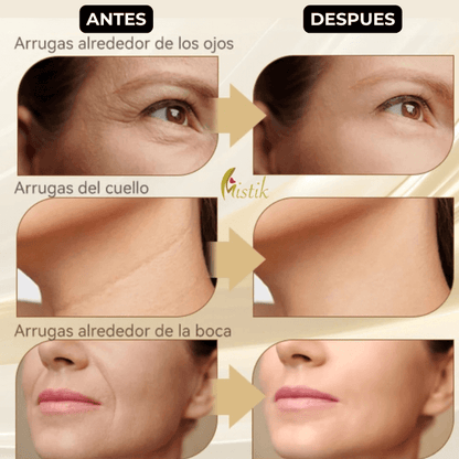 Masajeador Facial Rejuvenecedor PREMIUM